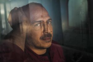 大人ニキビの赤みを和らげるためのレチノールの効果は？