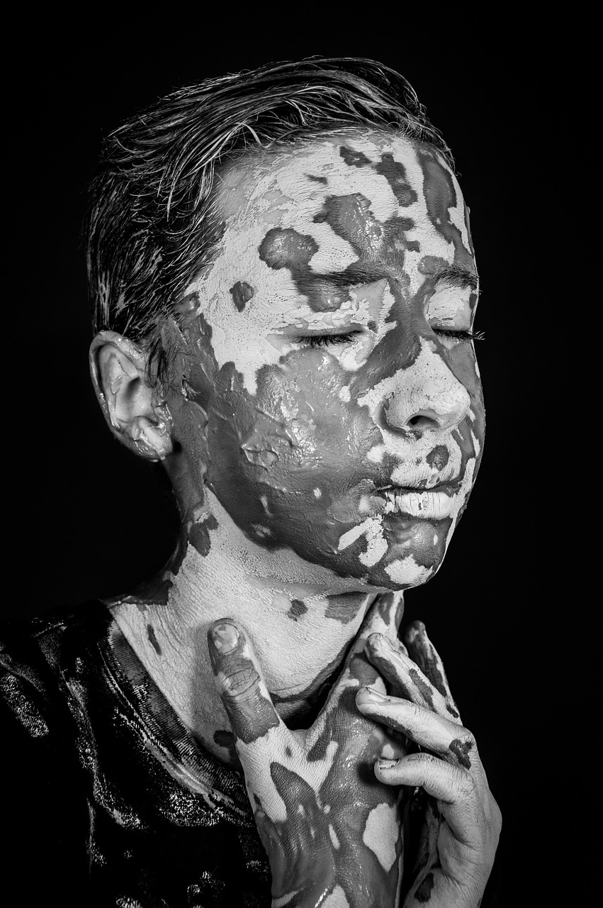 大人ニキビの跡を色素沈着から早く消す方法は？